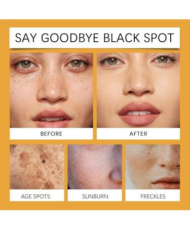 Melanin Correcting Cream Melanin Correcting Body Cream Melanin Repair Cream Body Moisturiser for Dry Skin Dark Spot Corrector Cream for Body Underarm Dark Knees and Elbows Neck Armpit - Buy Online on SooperMarket.com