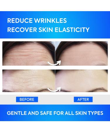 SILKDERMIS Forehead Wrinkle Patches - 12 Pack Anti Wrinkle Patches with Aloe, Collagen & Vitamin E for Forehead Wrinkles Treatment - Buy Online on SooperMarket.com