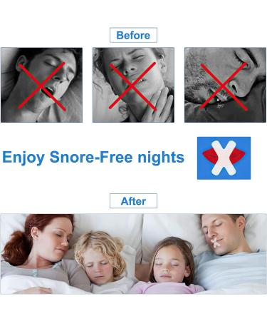 Mouth Tape for Sleeping (120 Pcs) - Advanced Sleep Strips for Better Breathing | Snoring Relief & Improved Sleep Quality - Buy Online on SooperMarket.com