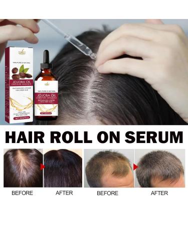 Hair Growth Oil | Jojoba & Wild Oil - Natural Anti-Frizz Density Boost for Men & Women - 30 ml | Aznever - Buy Online on SooperMarket.com