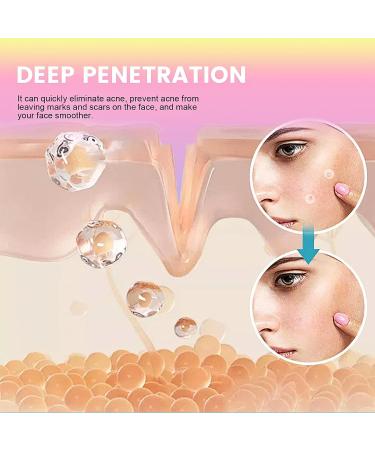 Acne Pimple Patches 96 Dots Colourful Spot Patches Hydrocolloid Patches Acne Patch Star Pimple Patches Cute Blemish Patches Acne Patches Spot Face Body Blemish Cover Skin Care - Buy Online on SooperMarket.com