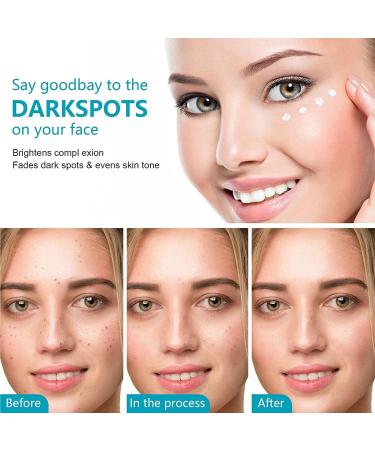 Dark Spot Remover Cream for Face & Body 50ml Dark Spot Corrector with Arbutin and Niacinamide Prevent Forming Dark Spots Fade Spots Reduces Hyperpigmentation Improve Skin Tone - Buy Online on SooperMarket.com
