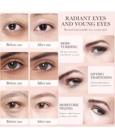 Retinol Eye Cream - Retinol Stick - Eye Cream for Dark Circles and Puffy Eyes - Under Eye Cream Anti Aging - Dark Circle Eye Cream - Eye Balm Reduce Lines Wrinkles Puffiness and Dark Circles - Buy Online on SooperMarket.com