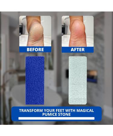 Love Natural Pumice Stone for Feet - 2-in-1 Exfoliating Scrubber for Dead Skin & Callus Removal - Professional Foot Care Rock (Blue - Buy Online on SooperMarket.com