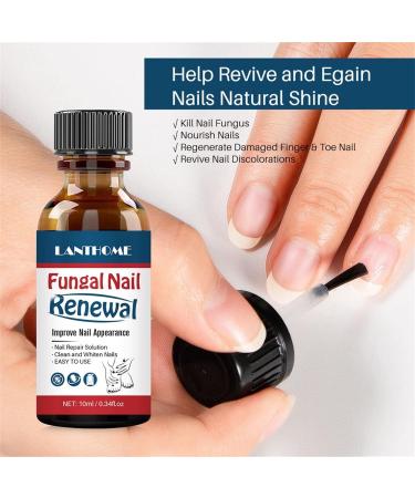 Nail & Cuticle Repair Oil - Promotes Growth & Regeneration for Natural & Acrylic Nails - 1 Piece (Brown) - International Shipping - Buy Online on SooperMarket.com