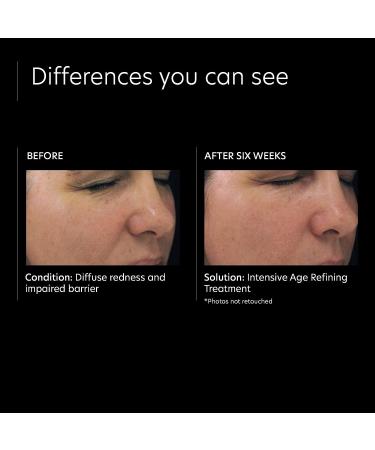 PCA SKIN Intensive Anti-Aging Face Serum with 0.5% Pure Vitamin A Retinol - 1 oz - Targets Uneven Skin Tone, Fine Lines, and Wrinkles - Buy Online on SooperMarket.com