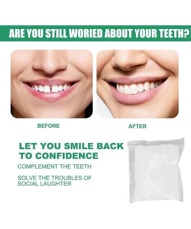 Temporary Teeth Repair Kit - Moldable Thermal False Teeth Fitting Beads - 50g - Buy Online on SooperMarket.com