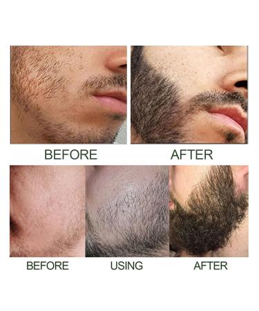 East Moon Beard Shaping Pen 2PC Set | Beard Growth Serum Oil & Roller | Best Gift for Men - Buy Online on SooperMarket.com