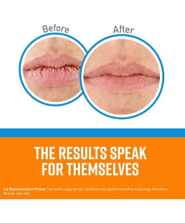 O'Keeffe's Lip Repair No Scent Lip Balm 0.15 oz - Moisturizing Long-Lasting Lip Care for All Skin Types - Buy Internationally - Buy Online on SooperMarket.com