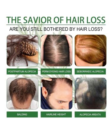 Organic Rosemary Oil for Hair Growth | Scalp & Hair Powering Aroma Therapy | Bexdug Pink Marine Oil with Glass Dripper - Improves Split Ends & Dry Scalp - Buy Online on SooperMarket.com