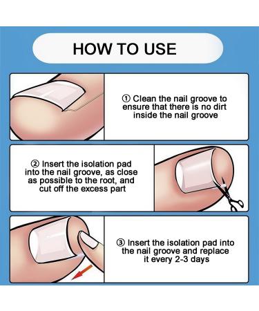 Ingrown Toenail Correction Set - 42 C-Shaped Fill Padding | Simple Tool for Ingrown Toenail Relief - Buy Online on SooperMarket.com