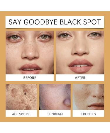 Melanin Correcting Cream Body Moisturiser for Dry Skin Melanin Correcting Body Cream Melanin Repair Cream Dark Spot Corrector Cream for Body Underarm Dark Knees and Elbows Neck Armpit - Buy Online on SooperMarket.com