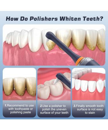 HassoKon Tooth Polisher Kit for Stain Removal & Teeth Whitening - Blue - Buy Online on SooperMarket.com