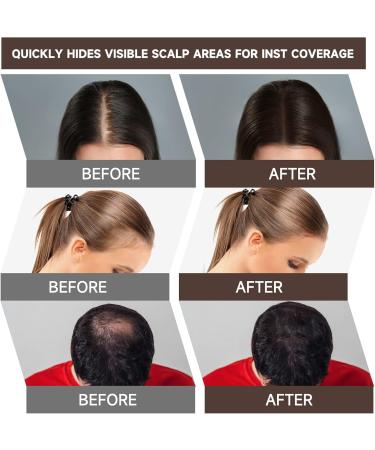 MIFELOY Root Touch Up Powder Cover Up Hair Color for Grays Root Coverage for Women Men Roots Concealer for Beard Line Eyebrow Instantly Shadow Powder for Thinning Grey Hairline Dark Brown - Buy Online on SooperMarket.com