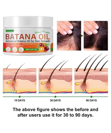 Organic Batana Oil for Hair Growth - 100% Natural Hair Mask & Scalp Treatment 120g for Repairing Damaged Hair & Skin - Buy Online on SooperMarket.com