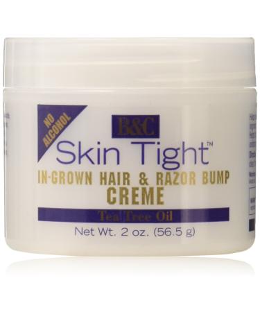 Skin Tight In-grown Hair & Razor Bump Creme, 2 Ounce