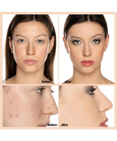 Aquapurity Phoera Full Coverage Foundation 30ml - 103 Warm Peach | Soft Matte Oil Control Concealer for Flawless & Long Lasting Results - Buy Online on SooperMarket.com