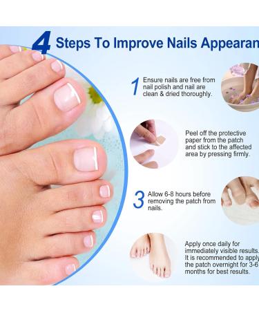 Fungal Nail Treatment - Nail Fungus Treatment for Toenail - Toe Nail Treatment Extra Strong - Nail Repair Treatment for Restores Damaged Nails - 8 Hours Nail Repair Restores Healthy Nails(32 Patches) - Buy Online on SooperMarket.com