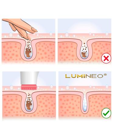 Lumineo Facial Gel for Blemished Skin | Cleansing Foam for Acne & Impurities | Compatible with Electrical Facial Brushes - Shop Now! - Buy Online on SooperMarket.com