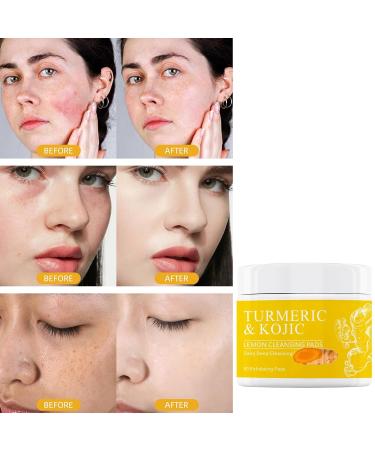 Buy Turmeric Cleansing Pads | Exfoliating Face Wash with Kojic Acid | Dark Spot Remover | International Shipping - Buy Online on SooperMarket.com