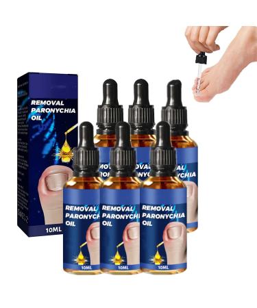 6PCs German Toenailcare Removal Paronychia Oil  Ingrown Toenail Nail Repair  German Toenailplus Anti Paronychia Relief Oil Nail Renewal Liquid for Damaged & Discoloration Nail