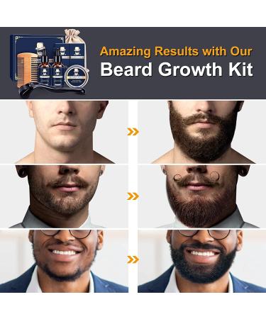 Beard Growth Kit with Derma Roller, Oil, Balm, Comb - Facial Hair Growth Products for Men - Perfect Birthday Gift - Buy Online on SooperMarket.com