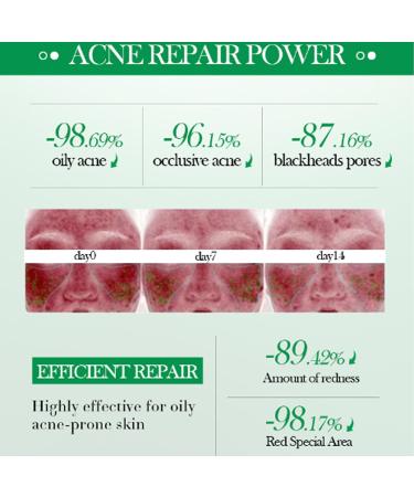 Salicylic Acid Repair Cream - Face Moisturizer for Acne-Prone Skin | Pore Shrinkage & Scar Improvement | 50g - Buy Online on SooperMarket.com