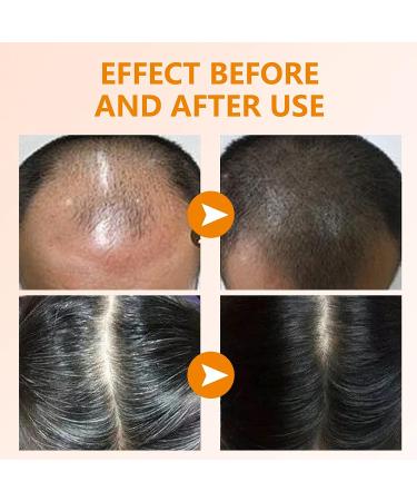 Turmeric Shampoo & Conditioner Bar for Hair Growth & Strengthening | 120g/4.23oz - Buy Online on SooperMarket.com