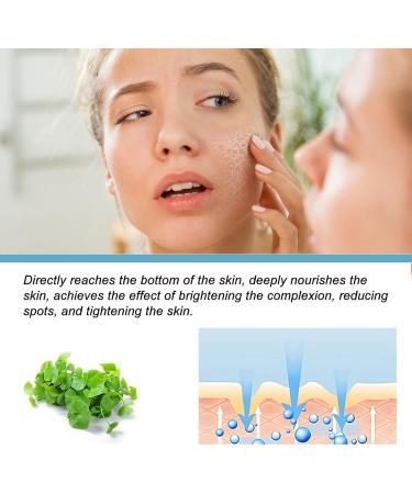 Nmbol Skin Lightening Serum B5 Spot Correction Serum B5 Corrector Serum Pigment Spot Remover Serum B5 Against Pigment Spots Wrinkle Reduction and Adolescent Radiation - Buy Online on SooperMarket.com