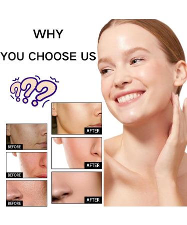 Tongyend Niacinamide Face Serums Niacinamide Serum Pore Minimizer & Brightening Facial Essence With Hyaluronic Acid Moisturiser For Acne Scar Lightening Skin Rehydration Pore Refinement and Soothing - Buy Online on SooperMarket.com