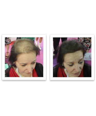 Dark Brown Hair Loss Concealer Trial Size - Cover Bald Spots Instantly - 10-Day Supply - All-Natural Fiber Formula - Buy Online on SooperMarket.com