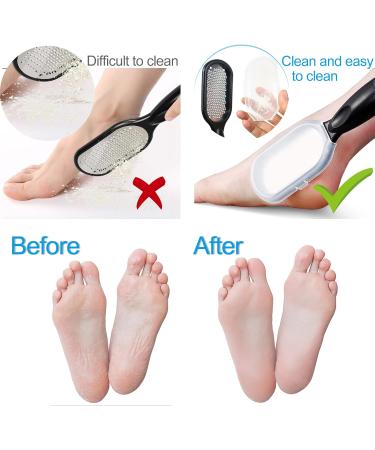 Sularpek Foot File Foot Scraper Best Foot Care Pedicure Metal Surface Tool to Remove Hard Skin Can Be Used on Both Wet and Dry Feet Surgical Grade Stainless Steel File - Buy Online on SooperMarket.com
