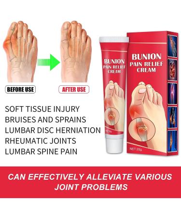 Refreshing Bunion Cream for Toe Swelling Relief - Gentle and Safe Health Care Solution - Buy Online on SooperMarket.com