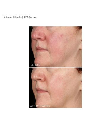 Dr. Dennis Gross Vitamin C Lactic 15% Firm & Brighten Serum 1 oz - Anti-Aging Solution - Buy Online on SooperMarket.com
