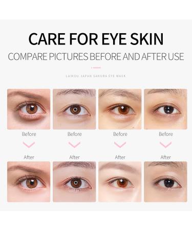 Eye Mask JAPAN SAKURA - 100pcs Nourishing Eye Patches for Puffy Eyes Dark Circles & Under Eye Bags - Buy Online on SooperMarket.com