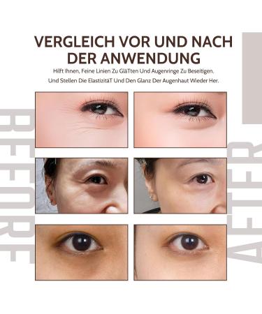 Caffeine Solution Caffeine Eye Serum Eye Cream for Dark Circles and Puffy Eyes Eye Cream for Anti-Aging Wrinkles - Buy Online on SooperMarket.com