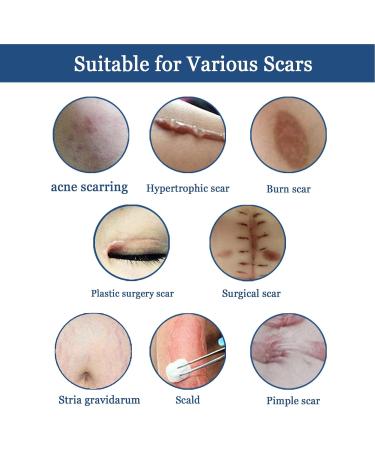 Scar Gel - Skin Repair and Removal Treatment for Face, Body, Surgery, Burns, Stretch Marks - Buy Online on SooperMarket.com