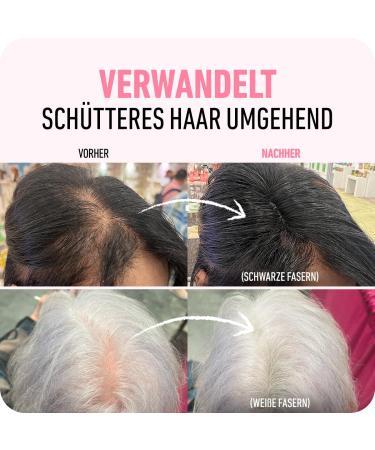 Boldify Scatter Hair Powder for Thinning Hair - Dark Blonde Natural & Invisible 56g - Hides Hair Loss in 15 Sec Perfect for Men & Women - Buy Online on SooperMarket.com