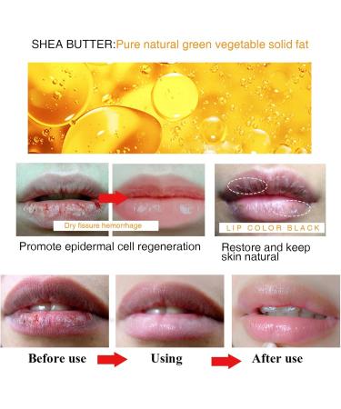 Lip Lightening For Dark Lips Moisturizing Lip Balm Whitening & Brightening Lip Balm Lips Pink Bleaching Cream Balm Lip Care Lightens Remove Dark Lips (1PC) - Buy Online on SooperMarket.com
