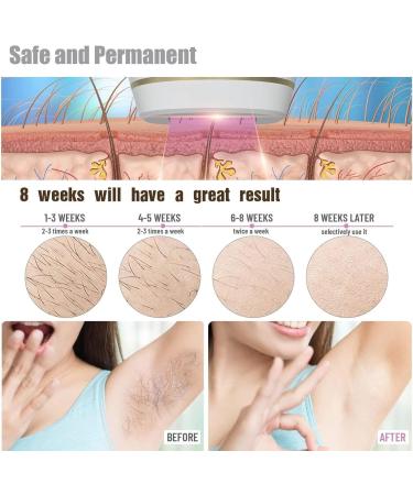 IPL Hair Removal Device | Portable Luxy Hair Remover for All Body | Fast International Shipping - Buy Online on SooperMarket.com