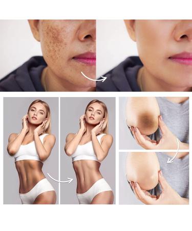 Intimate Area Dark Spot Corrector - Underarm, Knees, Elbows, Thighs, Private Parts Cream - Buy Online on SooperMarket.com