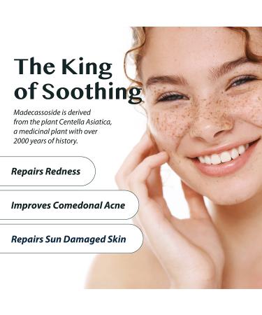 A'PIEU Madecassoside 2X Cream 4.06oz for Combination Skin - Soothes Dryness, Sun Damage, Dark Spots - Centella Asiatica Formula - Buy Online on SooperMarket.com