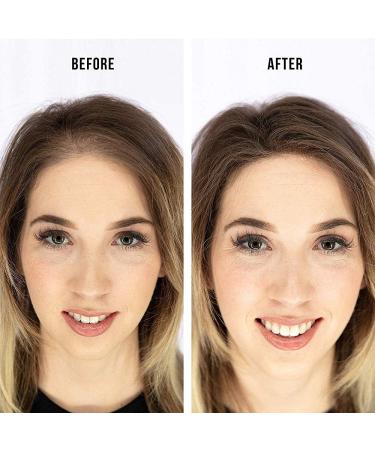 Dark Brown Hair Building Fibers for Thinning Hair, Bald Spots - Keratin Hair Re-growth Powder for Men and Women - Buy Online on SooperMarket.com