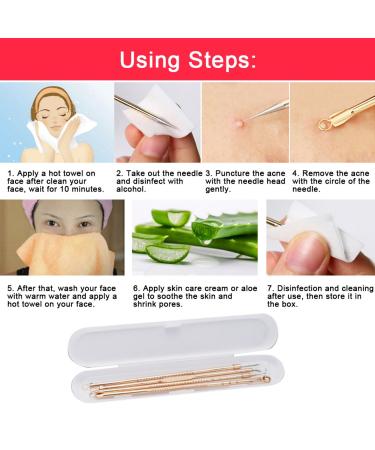 Acne Needles Set - 4Pcs Stainless Steel Blackhead & Blemish Removal Tools | Effective Pimple Solutions - Buy Online on SooperMarket.com
