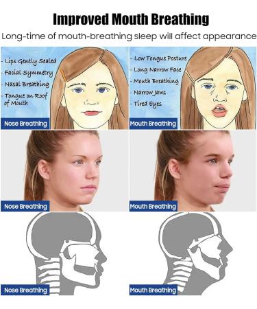 Mouth Tape for Sleeping (120 Pcs) - Advanced Sleep Strips for Better Breathing | Snoring Relief & Improved Sleep Quality - Buy Online on SooperMarket.com