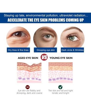 Jasmine Ointment for Dark Circles & Wrinkles - 2PCs Kaluofan Eye Cream with Collagen & Aloe Vera - Buy Online on SooperMarket.com