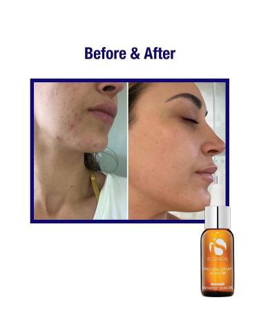 Pro-Heal Serum Advance+ | Antioxidant-rich Vitamin C, E & Retinol for Redness, Rosacea & Inflammation - Buy Online on SooperMarket.com