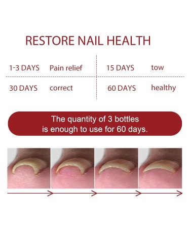 Top Nail Fungus Treatment: German ToenailPlus Kaluofan & More Effective Anti Paronychia Relief & Nail Care - Buy Online on SooperMarket.com