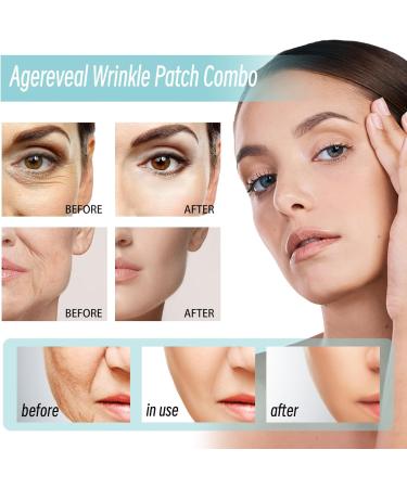 Face Wrinkle Patches Face Lifting Patches Face Lift Tape Anti Wrinkle Patches Reusable Silicone Wrinkle Pads Face Tape For Wrinkles Silicone Face Patches for Skin Lines Prevention - Buy Online on SooperMarket.com