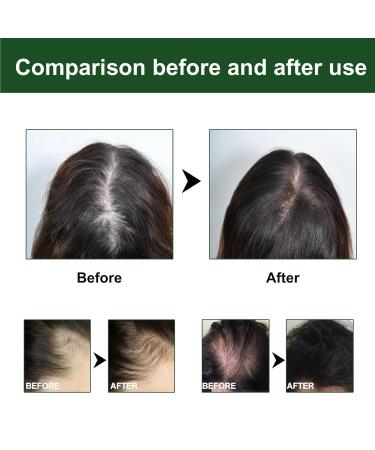 HMLTD Essential Rosemary Oil 60ml | Natural Hair Growth Oil for Dry Damaged Hair & Scalp Nourishment | Remedy for Hair Loss - Buy Online on SooperMarket.com